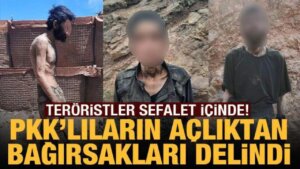 PKK’lı teröristlerin açlıktan bağırsakları delindi